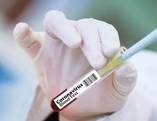 Continúa aumentando el número de casos de coronavirus en Las Rozas