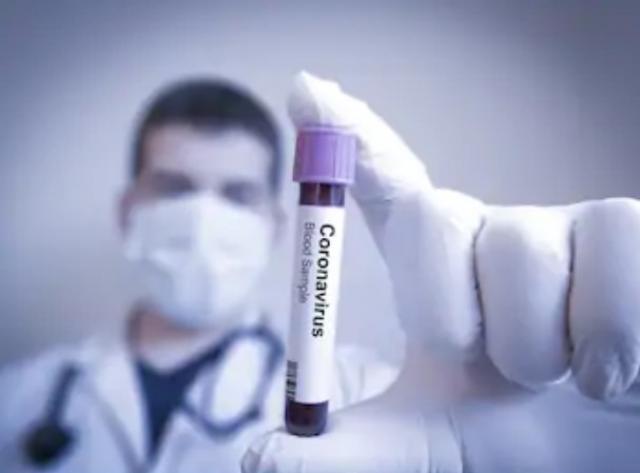 184 nuevos casos de Coronavirus en Las Rozas en la última semana